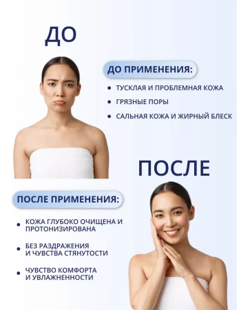 Тоник для жирной, проблемной кожи лица салициловый